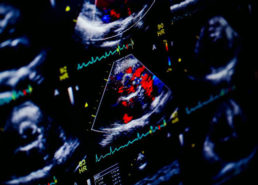 Echocardiography scan image